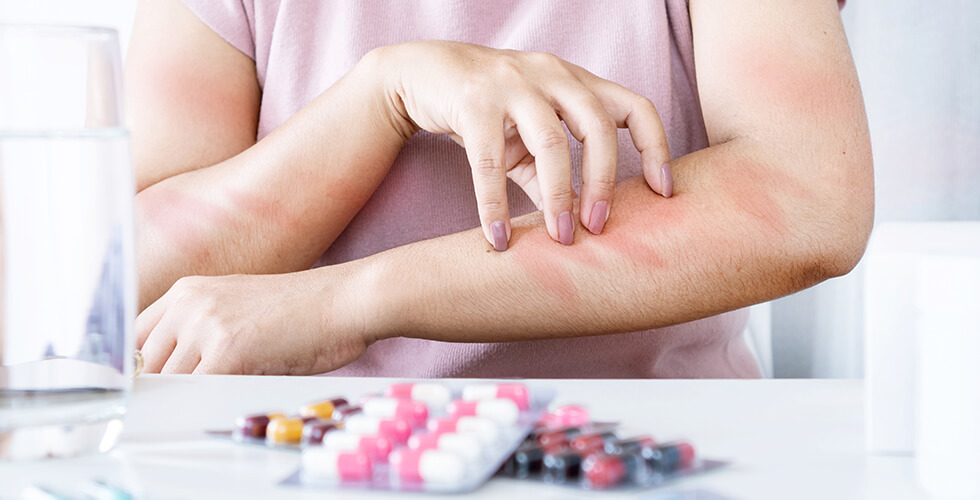 FDA Warns of Rare Itching Side Effect Linked to Popular Allergy Medications