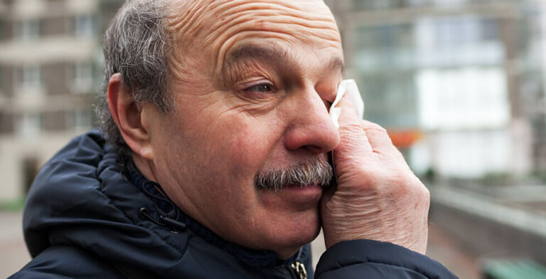 How Hay Fever Can Trigger Hair Loss—and What to Do About It