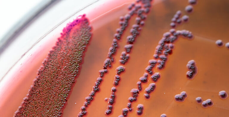 She Got Pink-Eye’s Evil Cousin: Woman Says Her Ex’s Fart Gave Her a 7-Year Infection