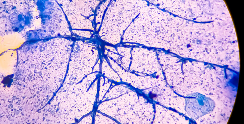 Skin’s Secret Weapon: How a Common Fungus Fights Super-Bug Staph