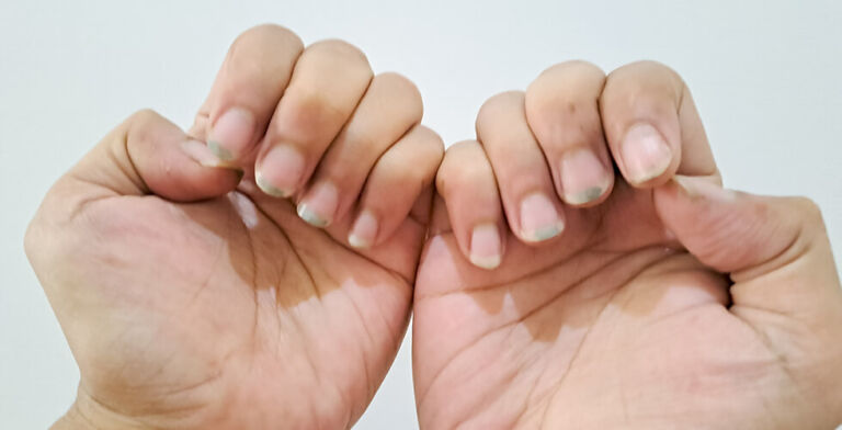 What’s Hiding Under Your Nails? Here’s Why You Need to Keep Them Clean