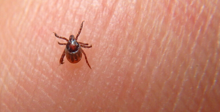 Don’t Forget to Look in These Places for Ticks