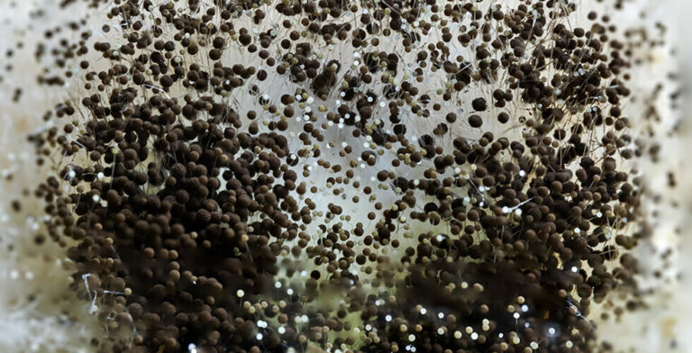 Flesh-Eating Fungus Spreads Across U.S.—Drug Resistance Makes It Even Deadlier