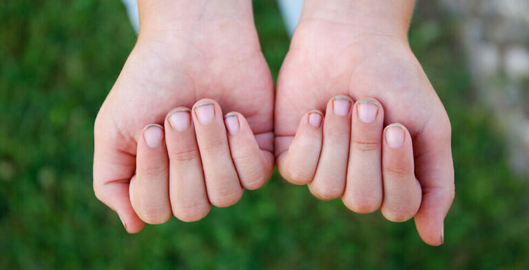 Ditch the Toothpick — Here’s Why Sharp Tools Under Your Nails Are Hurting You