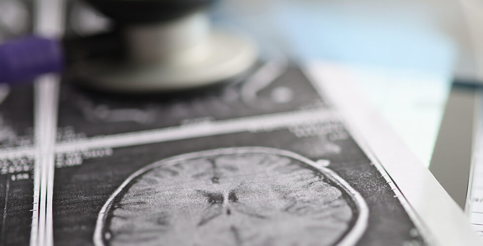 TheSweetSmellofDangerFitDadsOnlySymptomWasaPhantomCaramelScentItWasaDeadlyBrainTumor_AltDaily_980x500