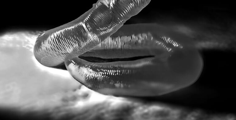 Eye-Opening Horror: Doctors Remove Live Worm from Man’s Eyeball