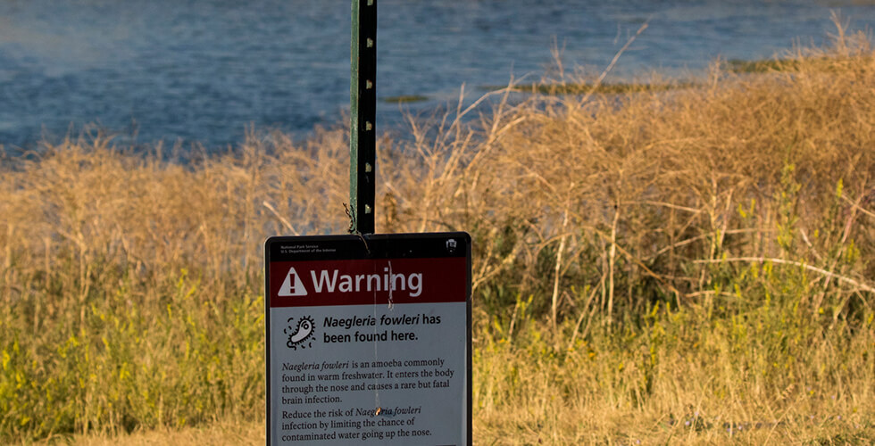 Rising Waterborne Threats: Brain-Eating Amoeba and Flesh-Eating Bacteria Cases Raise Concern