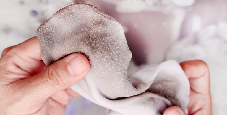 What’s Really Lurking in Your Socks? The Shocking Microbial Jungle Beneath Your Feet